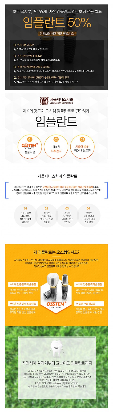 [임플란트 건강보험 적용] 